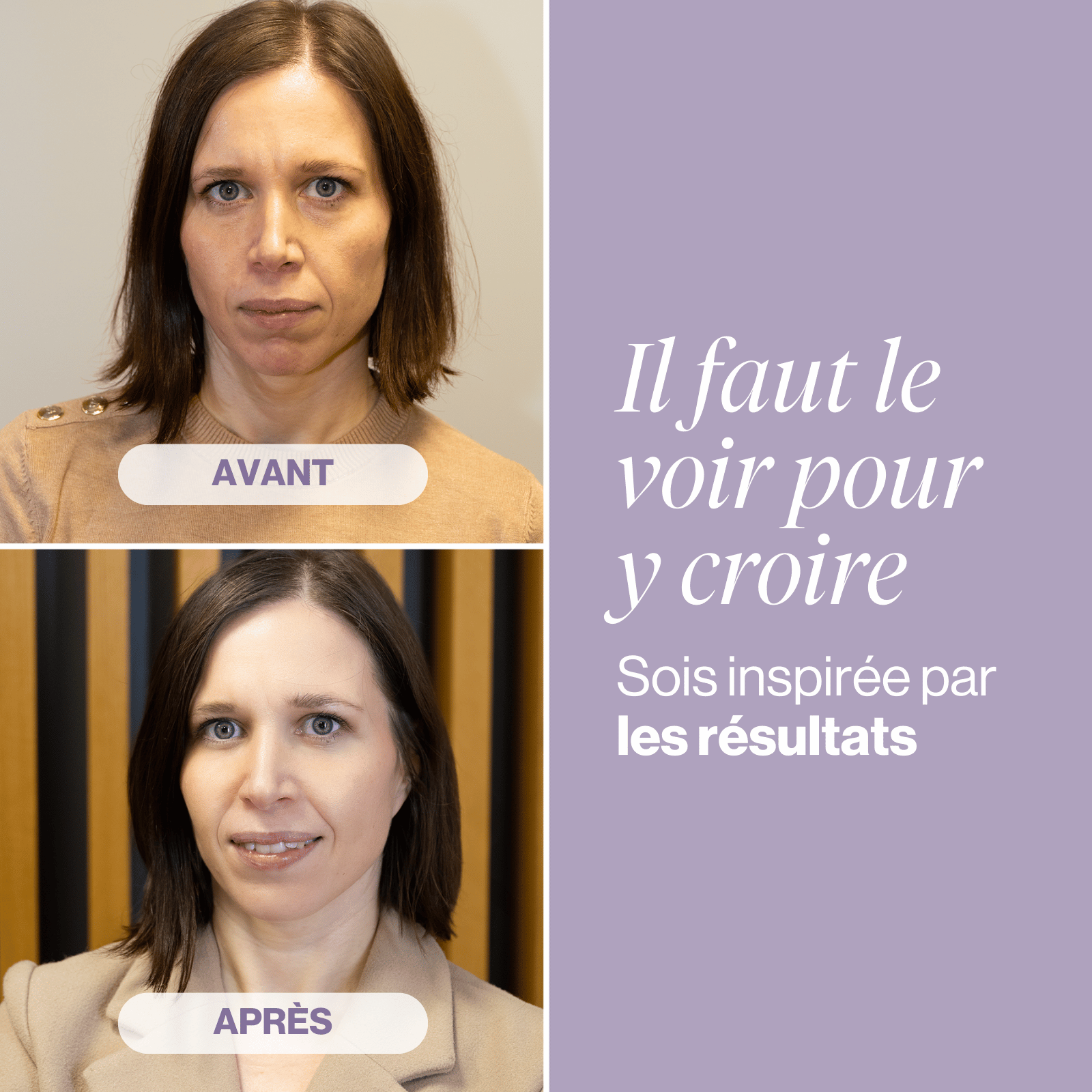 Biotic Collagen Shots pour une peau jeune et sans imperfections - 3 boîtes.